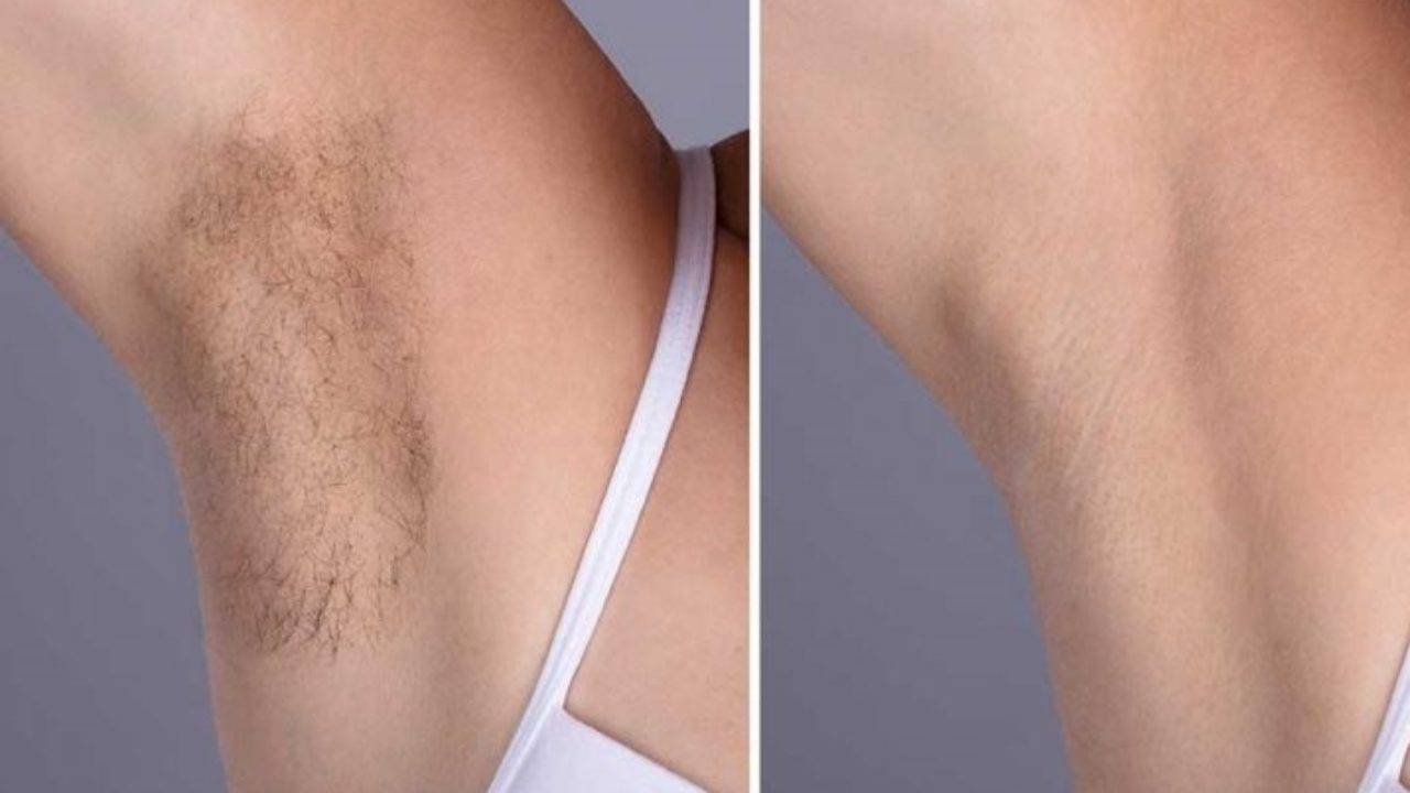 Un moyen facile d’enlever les poils sous le bras